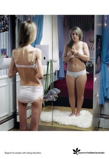 anorexie-pub-choc-500x728